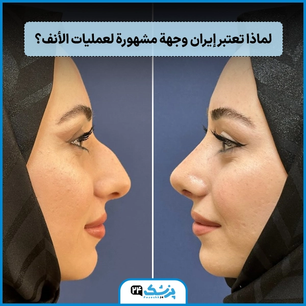 عملية تقويم الانف