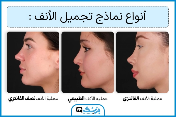 تعديل الانف