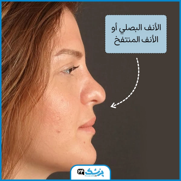 اشكال الانف انواع الخشوم