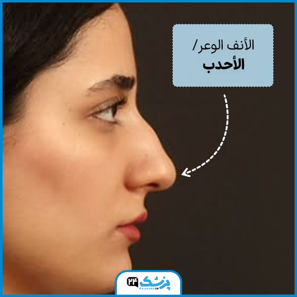 انواع اشكال الانف