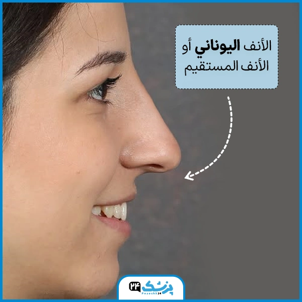 اشكال الانف واسمائها