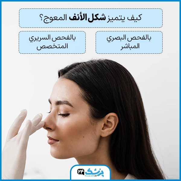 اشكال الانوف واسمائها