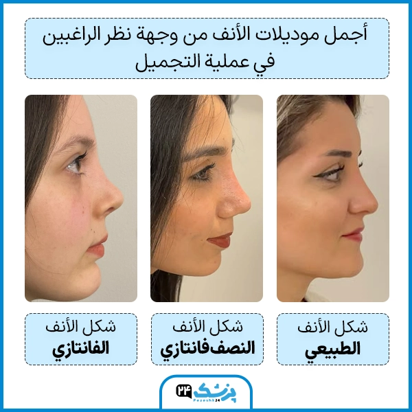 اجمل انواع الانف