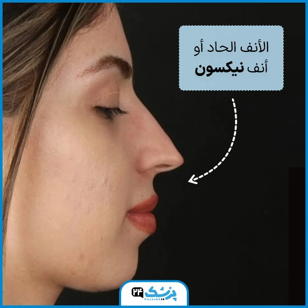 انواع الخشوم