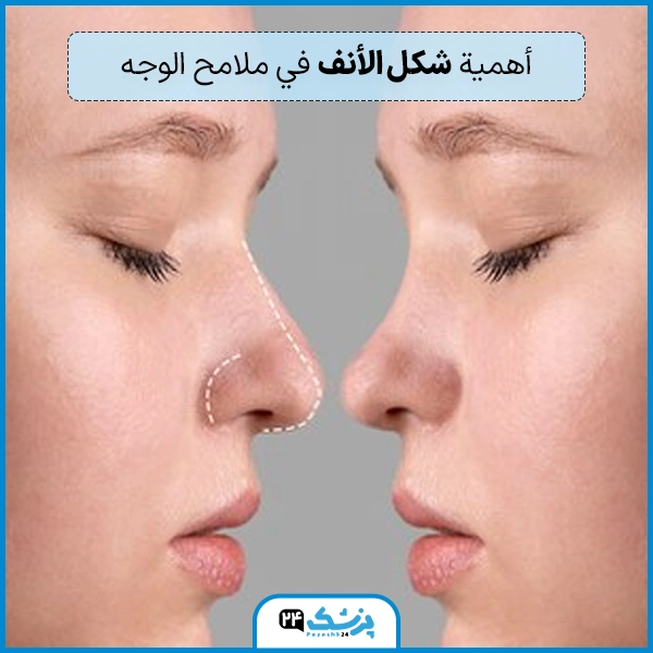 انواع الانف عند النساء