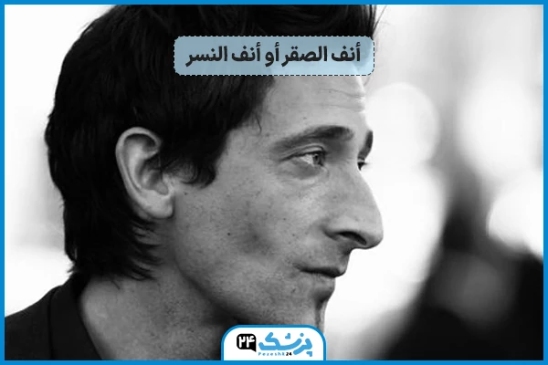 أنف الصقر أو أنف النسر