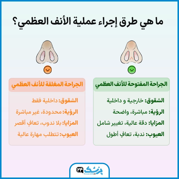ما هي طرق إجراء عملية الأنف العظمي؟