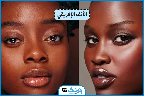 شكل الأنف الإفريقي