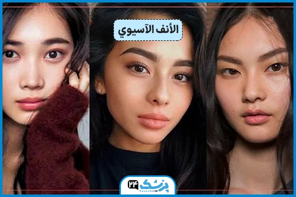 شکل الأنف الآسيوي