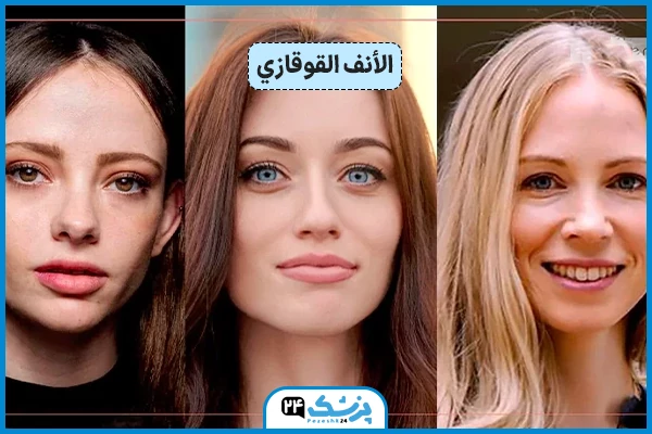 شكل الأنف القوقازي