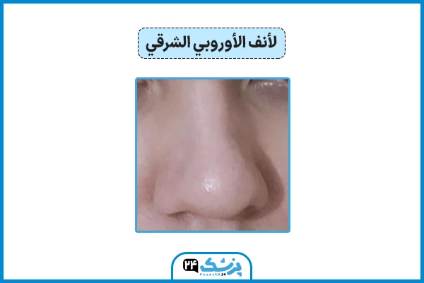 أنف أوروبا الشرقية