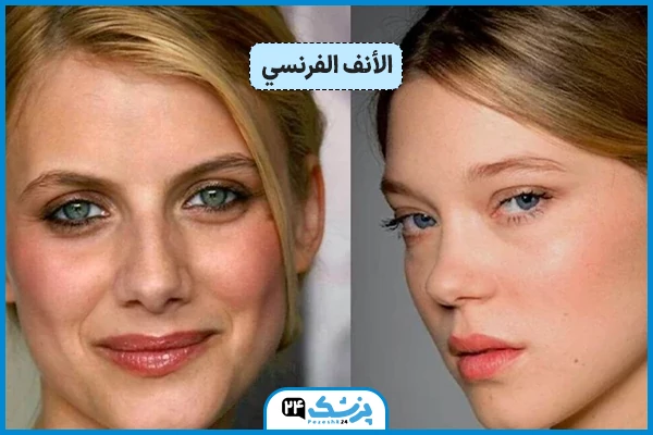 شکل الأنف الفرنسي