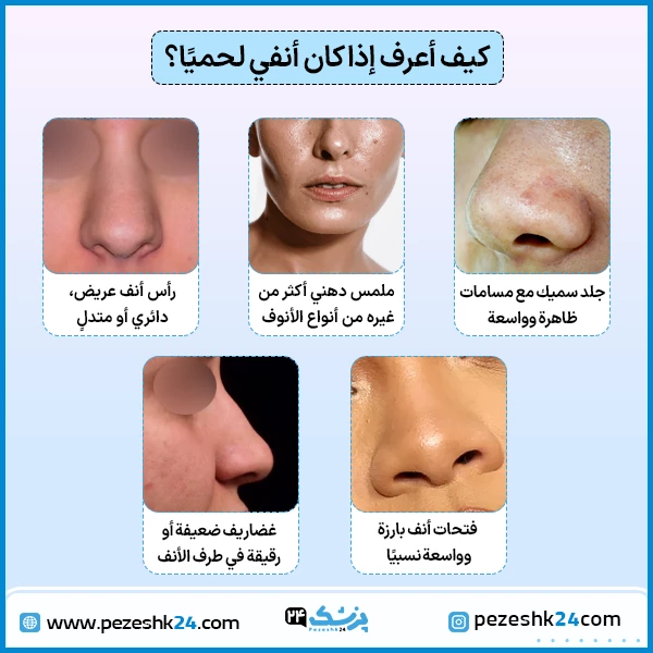 الخشم اللحمي