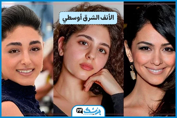 شكل الأنف الشرق أوسطي