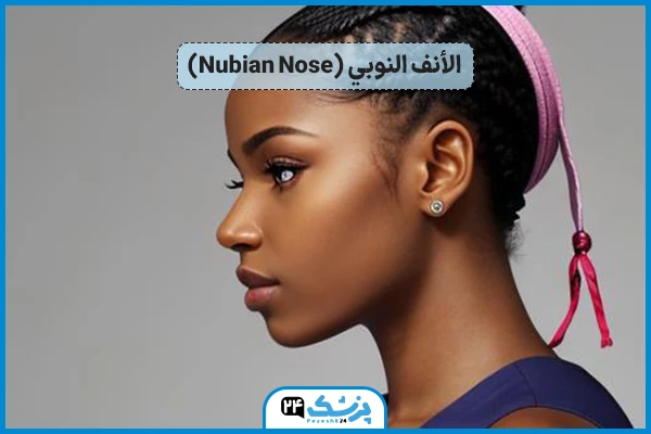 الأنف النوبي (Nubian Nose)