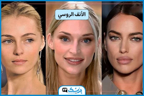 شکل الأنف الروسي