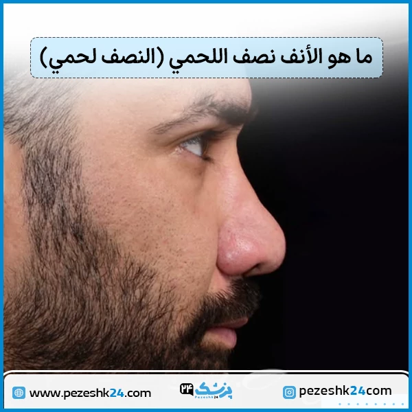 شكل الانف اللحمي