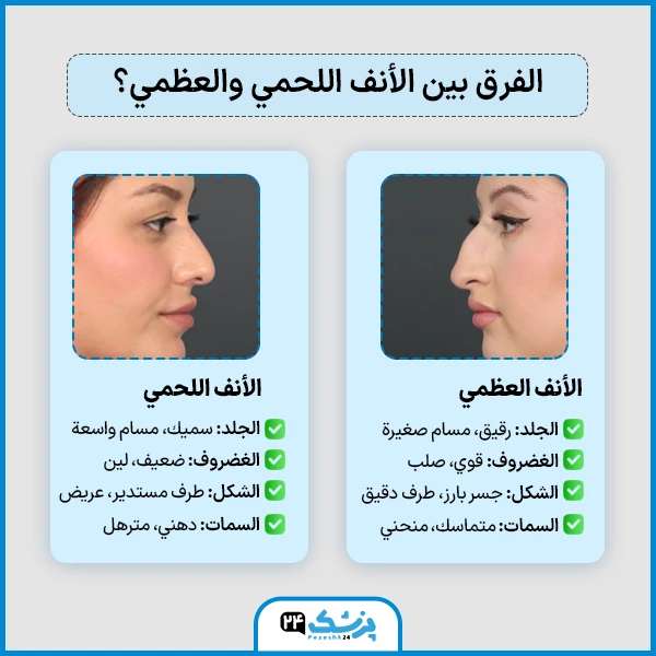 شكل الأنف العظمي
