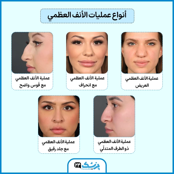 أنواع عمليات الأنف العظمي