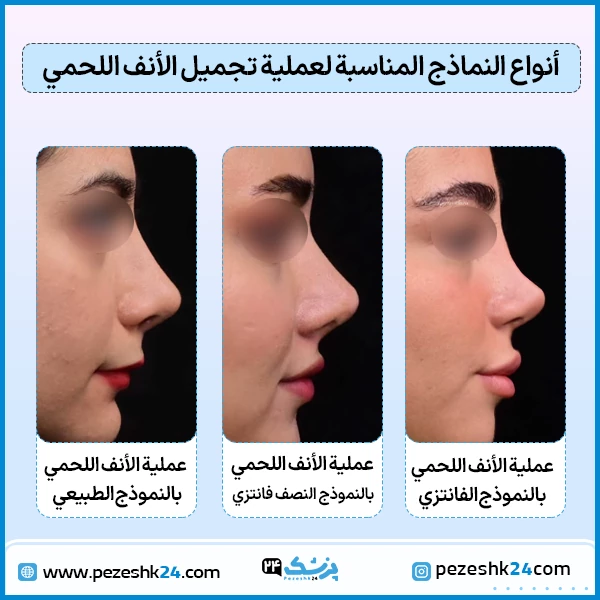 اشكال الانف اللحمي