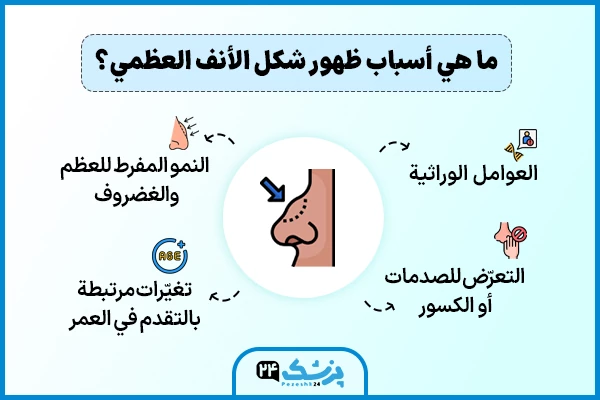 شكل الانف العظمي