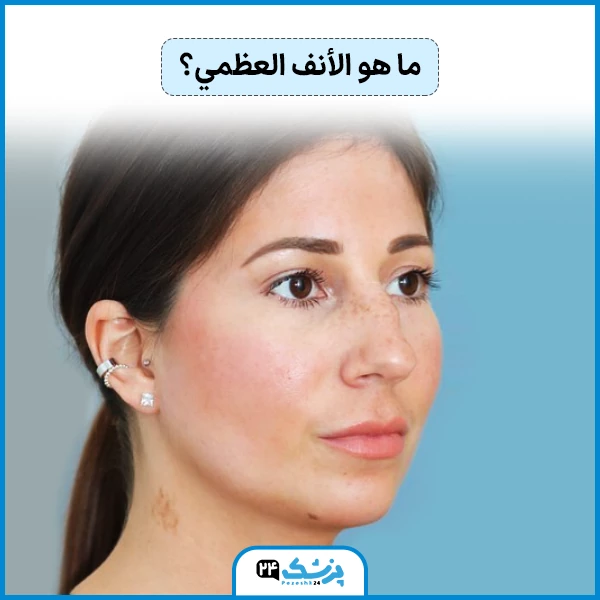الانف العظمي