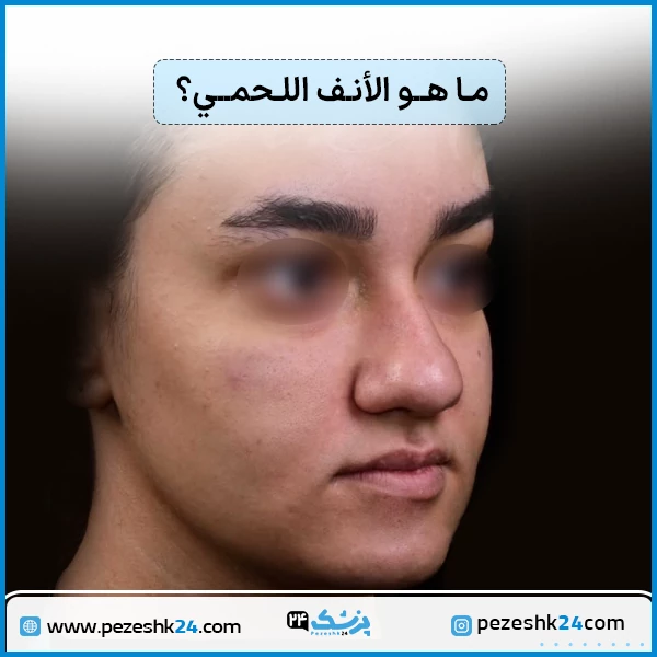 ما هو الانف اللحمي
