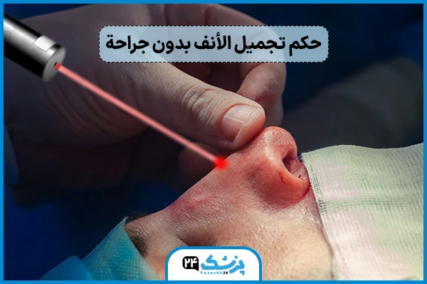 حكم تجميل الأنف بدون جراحة