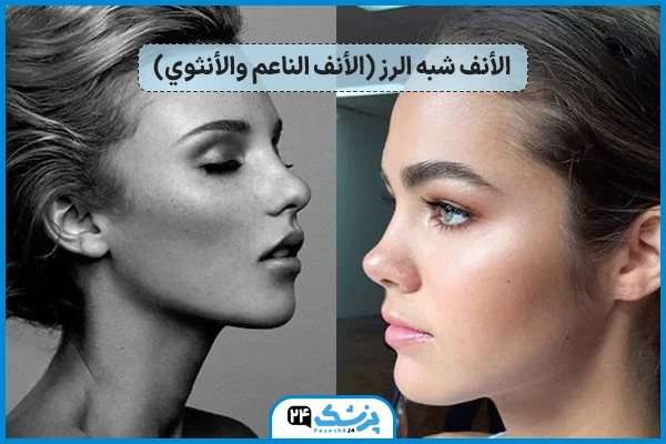 الأنف شبه الرز (الأنف الناعم والأنثوي)