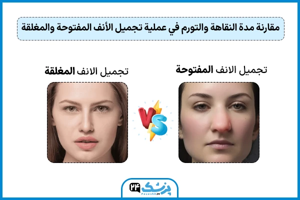 مقارنة مدة النقاهة والتورم في عملية تجميل الأنف المفتوحة والمغلقة