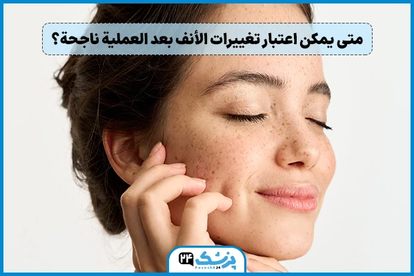 متى يستقر شكل الانف بعد عملية التجميل