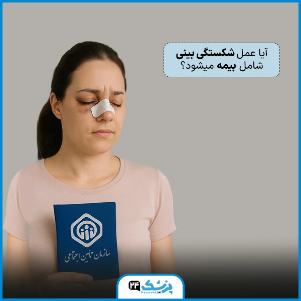 آیا عمل شکستگی بینی شامل بیمه میشود؟