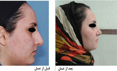 دکتر هادی سرمست جراح پلاستیک بینی در تهران 3