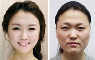 خصوصیت بینی ایرانی