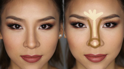 دستگاه های کوچک کننده بینی دستگاه های کوچک کننده بینی