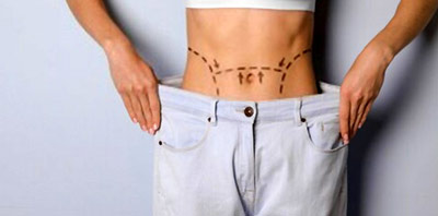 مراقبت های بعد از پیکرتراشی