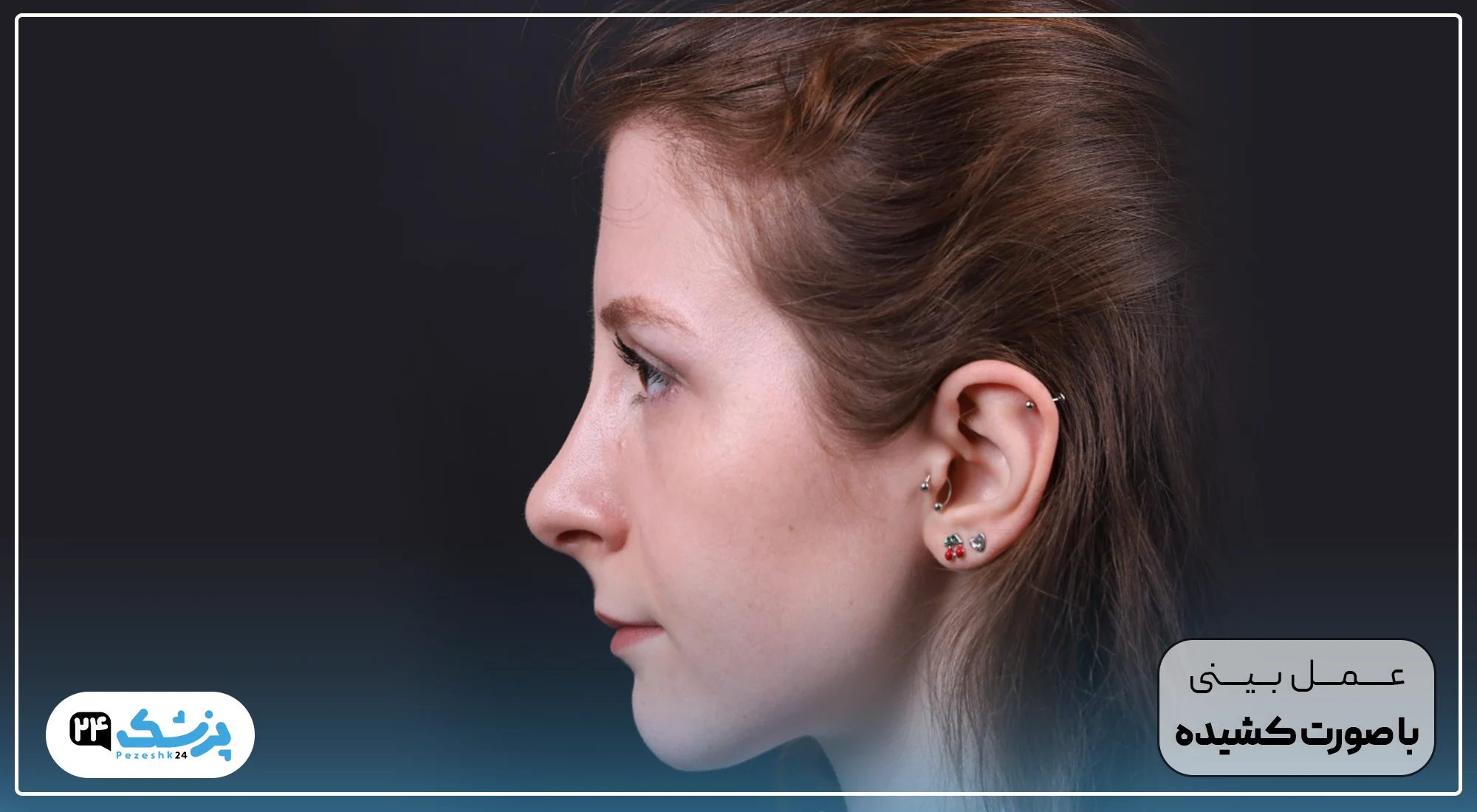 جراحی بینی صورت کشیده