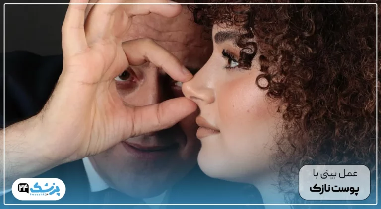 پوست نازک در عمل بینی