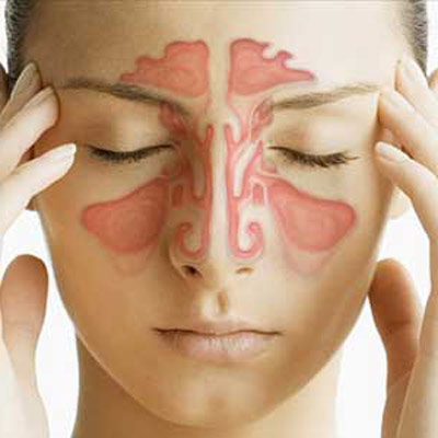 تاثیر سینوزیت بر روی جراحی بینی