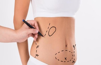 انجام جراحی پیکرتراشی در تبریز