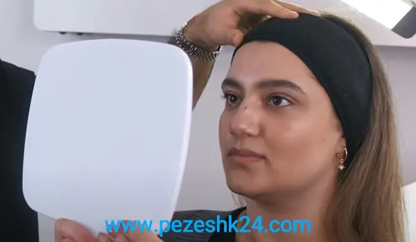 کوچک کردن بینی با لیزر در مشهد