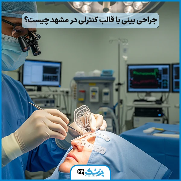 جراحی زیبایی بینی با قالب در مشهد