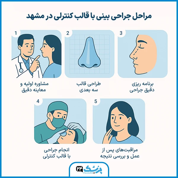 مراحل جراحی بینی با قالب کنترلی در مشهد