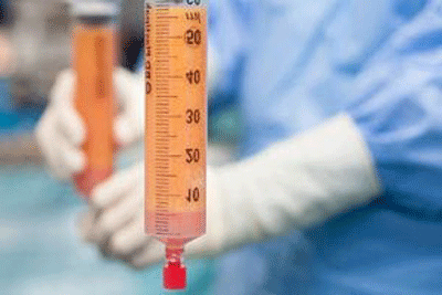 هزینه تزریق چربی به باسن