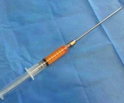 کاندیدای مناسب برای لیفت باسن برزیلی