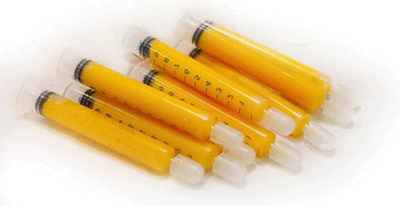 برداشتن چربی های مناسب برای لیفت باسن