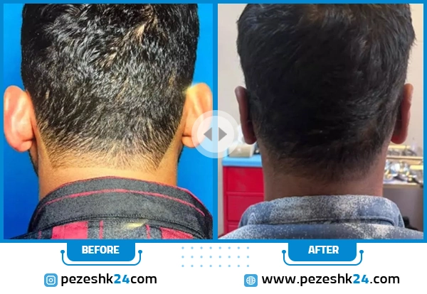 قبل و بعد جراحی گوش دکتر شکوهی شیراز