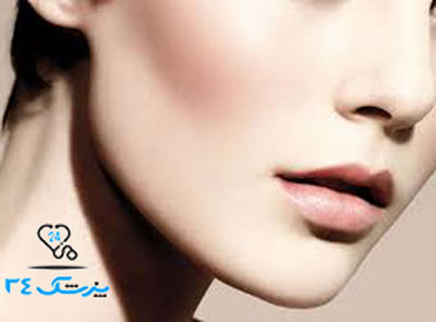 عمل چانه و مراحل آن