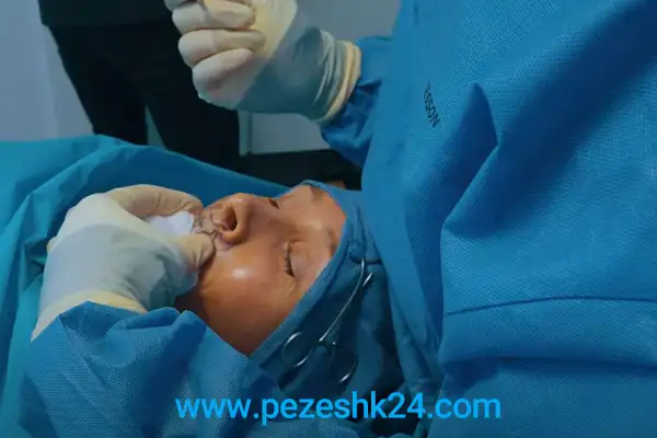 مرکز جراحی لب در اصفهان