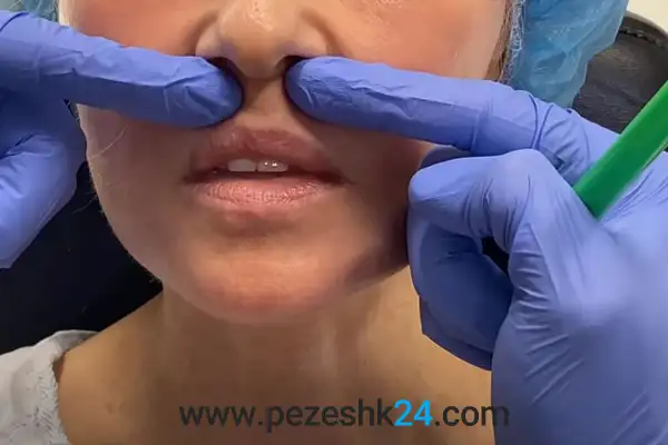 لیفت سانترال لب اصفها